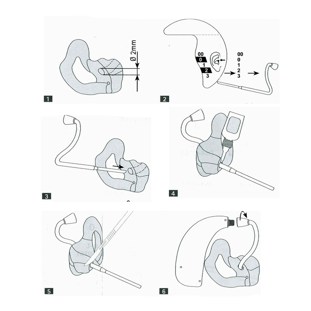 Phonak Hearing Aids Charging Instructions at Milagros Dammann blog